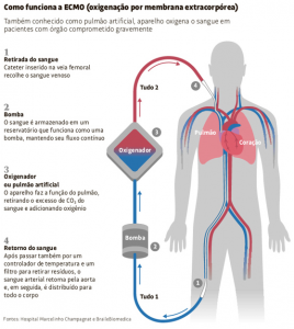 O que é a ECMO utilizada em pacientes com covid-19